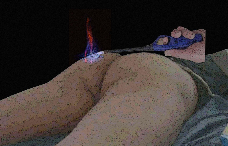 Ich suche - Flammen-Spiele mit dem Stab-Feuerzeug an meinem Po